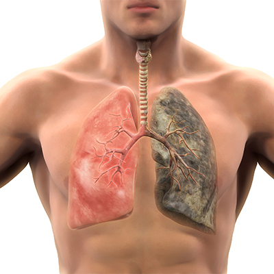 Lung Herbal Remedies and Cleanses